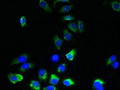 TMEM243 Antibody