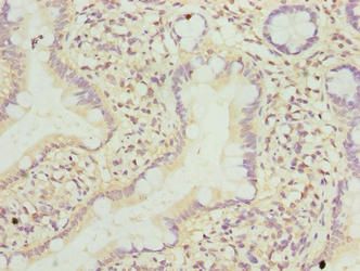 TMEM243 Antibody