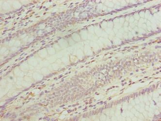TMEM243 Antibody
