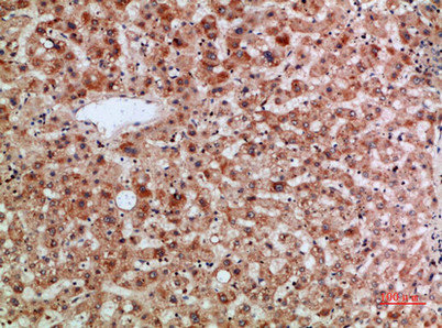 TMPO/TMPO Antibody