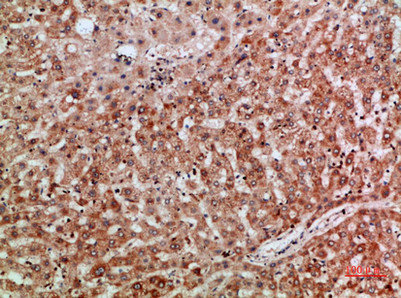 TMPO/TMPO Antibody