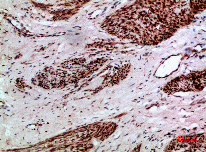 TMPO/TMPO Antibody