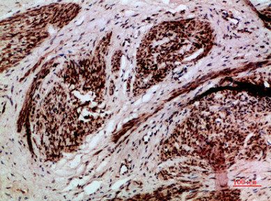 TMPO/TMPO Antibody
