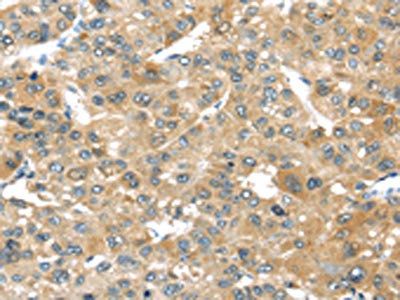 TMPRSS4 Antibody
