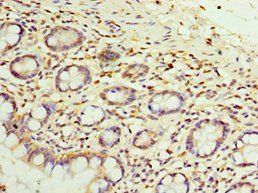 SULT1E1 Antibody