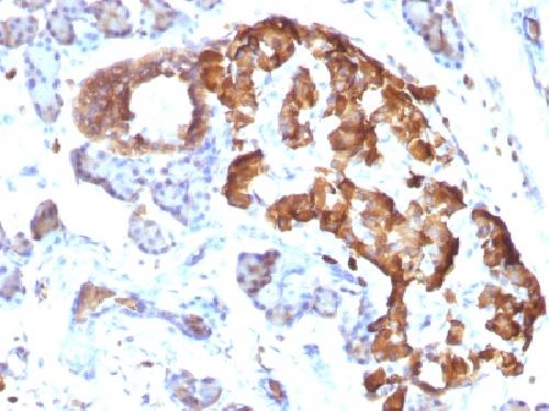 TNF-alpha (Tumor Necrosis Factor alpha) Antibody