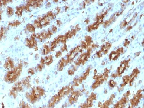 TNF-alpha (Tumor Necrosis Factor alpha) Antibody