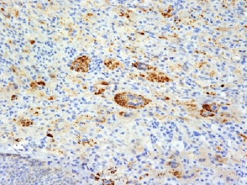 TNF-alpha (Tumor Necrosis Factor alpha) Antibody