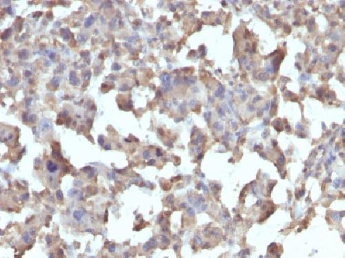 TNF-alpha (Tumor Necrosis Factor alpha) Antibody
