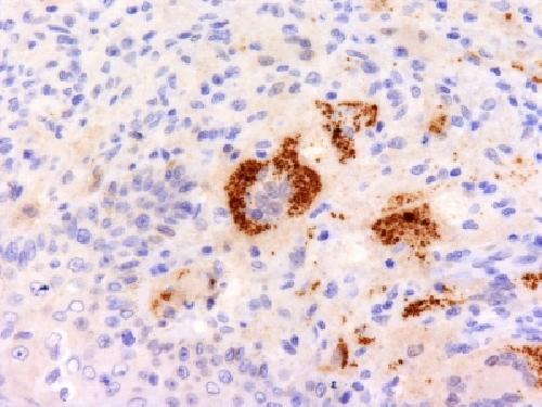 TNF-alpha (Tumor Necrosis Factor alpha) Antibody