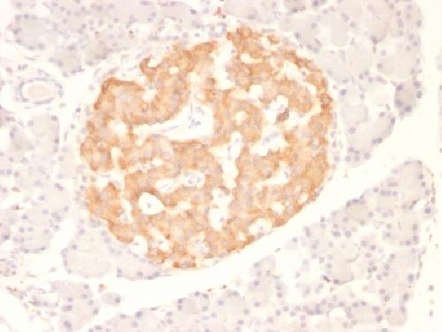 TNF-alpha (Tumor Necrosis Factor alpha) Antibody