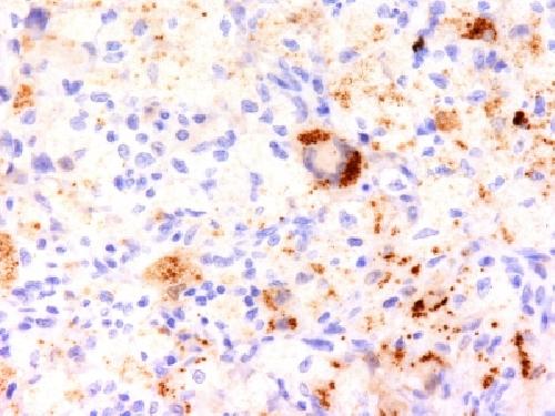 TNF-alpha (Tumor Necrosis Factor alpha) Antibody