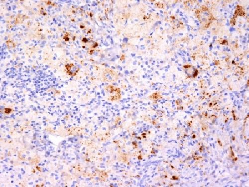 TNF-alpha (Tumor Necrosis Factor alpha) Antibody