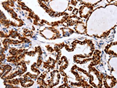 TNFAIP1 Antibody