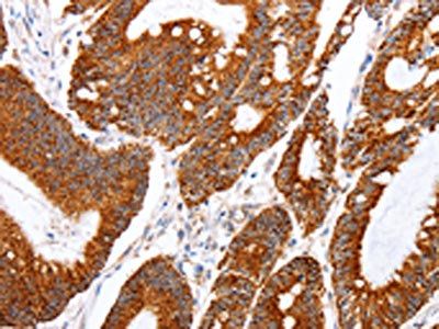 TNFAIP1 Antibody