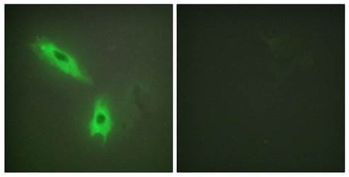 TNFC Antibody