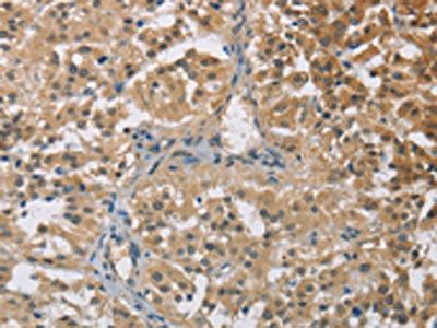 TNFRSF10D Antibody