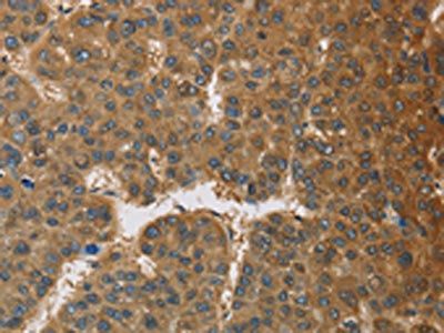 TNFRSF10D Antibody