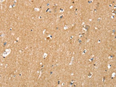 TNFRSF21 Antibody