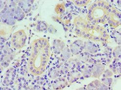 TNFSF13 Antibody