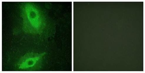 TNFSF15 Antibody