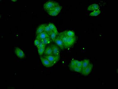TNKS Antibody