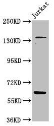 TNKS Antibody
