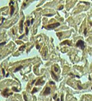 TNKS2 Rabbit Polyclonal Antibody