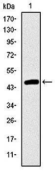 TNNI2