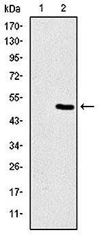 TNNI2