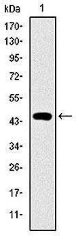 TNNI2