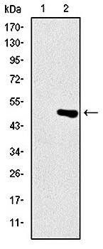 TNNI2