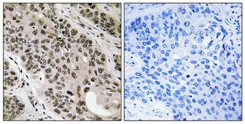 TNNI3K Antibody