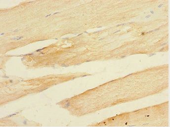 TOB2 Antibody