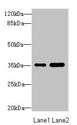 TOB2 Antibody