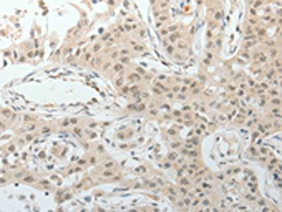 TOP1MT Antibody