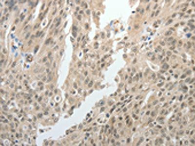 TOP1MT Antibody