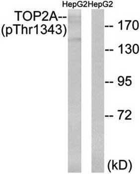 TOP2A (Phospho-Thr1343) Antibody