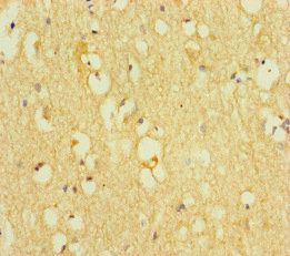 TOX3 Antibody