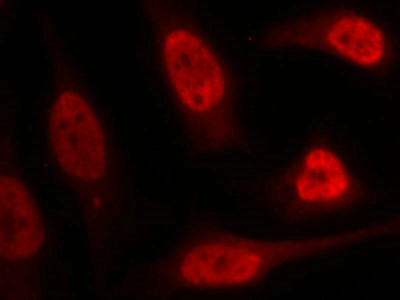 TP53 (Ab-15) Antibody