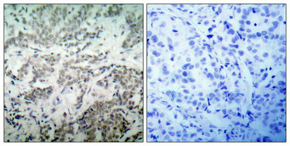 TP53 (Ab-15) Antibody