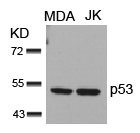 TP53 (Ab-15) Antibody