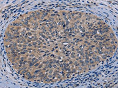 TP53AIP1 Antibody