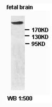 TP53BP1 Rabbit Polyclonal Antibody