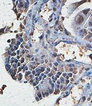 TP53BP1 Rabbit Polyclonal Antibody