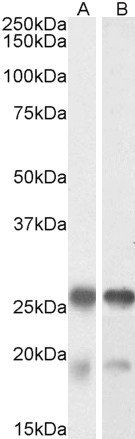 TPPP/p25 Antibody