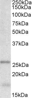 TPPP/p25 Antibody