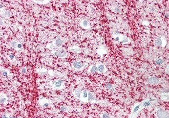 TPPP/p25 Antibody