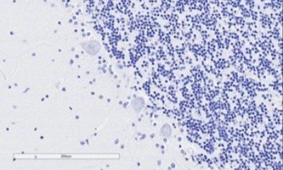 TPPP/p25 Antibody