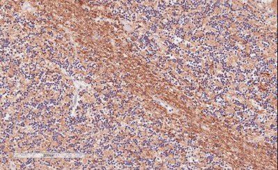 TPPP/p25 Antibody